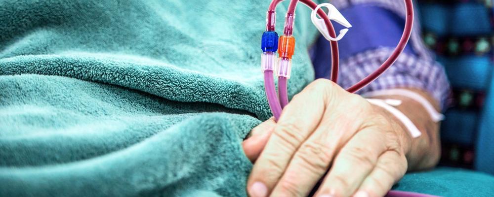 en kropp under en mjuk filt, en arm sticker ut som är uppkopplad i dialysutrustning. 